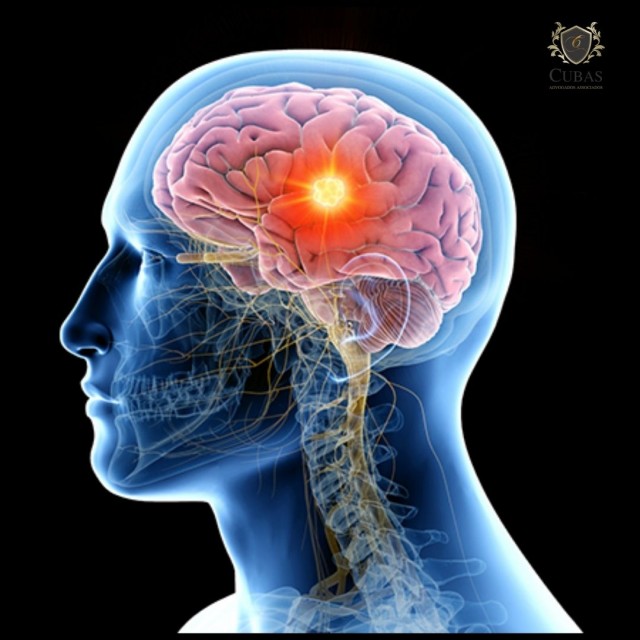 INSS deve restabelecer benefcio assistencial para jovem com hidrocefalia e tumor cerebral