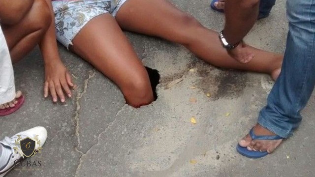 Mulher que caiu em buraco no sinalizado em condomnio ser indenizada em R$ 16 mil