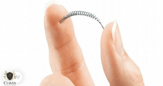 Paciente que sofreu efeitos colaterais aps colocar dispositivo contraceptivo deve ser indenizada