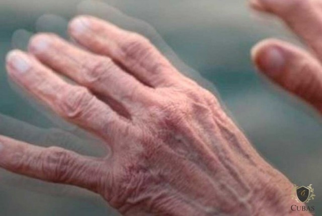 Unio deve restituir valores retidos indevidamente sobre aposentadoria de portador de Parkinson