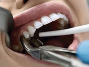 Clnica Odontolgica ter de indenizar paciente que sofreu leses graves em tratamento dentrio