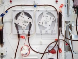 DF deve conceder transporte para hemodilise de paciente com sade debilitada