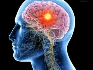 INSS deve restabelecer benefcio assistencial para jovem com hidrocefalia e tumor cerebral