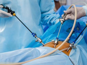 Operadora ter de pagar danos morais a paciente aps cirurgia baritrica