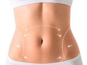 Paciente que ficou sem umbigo aps cirurgia plstica receber indenizao