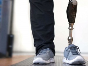 Xingado por furar fila, homem ser indenizado ao comprovar uso de prtese na perna